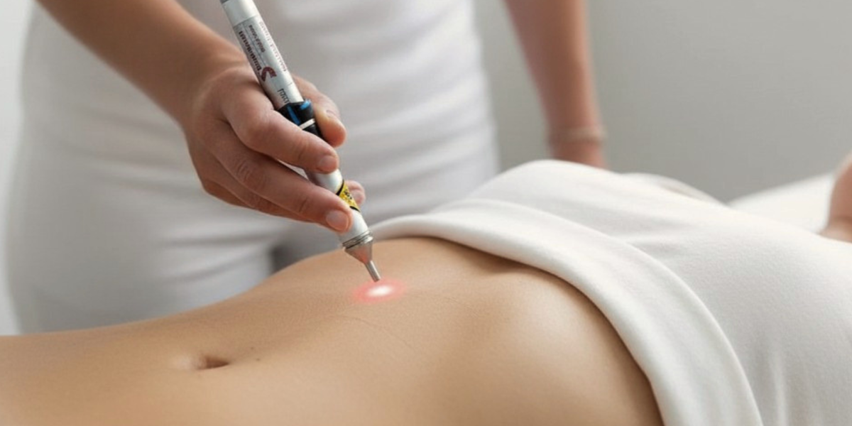 Lasertherapie für den Darm